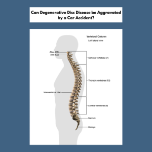 Can Degenerative Disc Disease be Aggravated by a Car Accident?